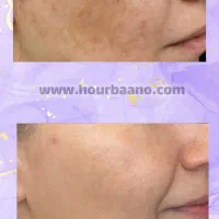 کلینیک زیبایی هوربانو جردن|خدمات آرایشگری و زیبایی|تهران, جردن|دیوار