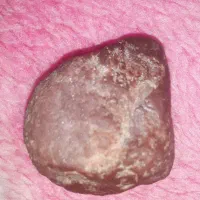 دو عدد مهر سنگ قدیمی