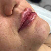 مرکز لیزر و زیبایی دکتر فروغ احمدی پور