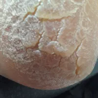 پدیکور و اپیلاسیون تخصصی با موم دائم