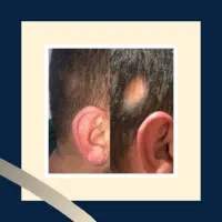 ریزش موهاتو متوقف کن