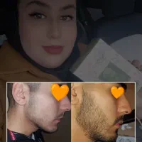 تقویت ریش و مو