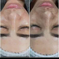 تخفیفات جشنواره فشیال و پاکسازی تخصصی پوست|خدمات آرایشگری و زیبایی|اصفهان, الهیه|دیوار