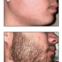 تضمین ریشات با من
