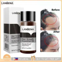 روغن رفع کچلی میخوای کچل نشی بزن|آرایشی، بهداشتی، درمانی|بومهن, |دیوار