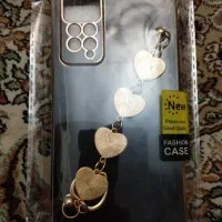 قاب redmi note11s