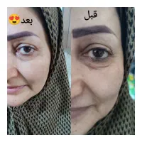 پاکسازی صورت با قیمت مناسب فقط فقط بانوان