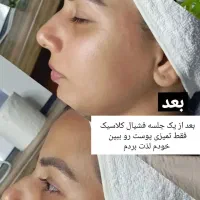 فشیال تخصصی پوست در محیطی آرام و بهداشتی