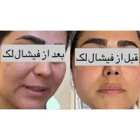 فیشیال ویژه بانوان عزیز و آقایون