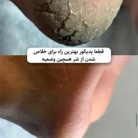 پدیکور ویژه اقایان