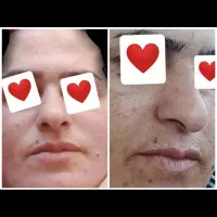 محصولات گیاهی درمانی|آرایشی، بهداشتی، درمانی|نیریز, |دیوار