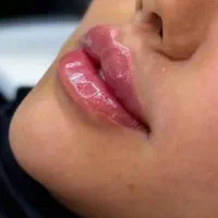 جشنواره تخفیفات تزریق ژل و بوتاکس و...|خدمات آرایشگری و زیبایی|کرج, گوهردشت|دیوار