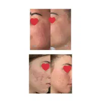 خدمات پوست و مو|خدمات آرایشگری و زیبایی|مراغه, |دیوار