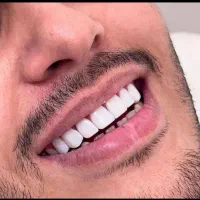 جشنواره کامپوزیت لمینت|خدمات آرایشگری و زیبایی|قم, بنیاد|دیوار