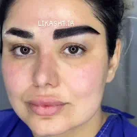 جشنواره طلایی کاشت ابرو سه بعدی کاشت مو (سوپر vip)|خدمات آرایشگری و زیبایی|تهران, سعادتآباد|دیوار