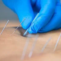 خدمات فیزیوتراپی توانبخشی در منزل