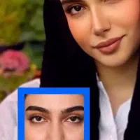 جشنواره ویژه عمل بینی