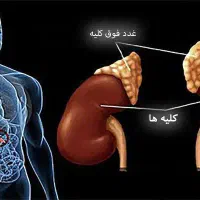 سنگ شکن گیاهی