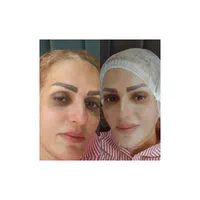 فشیال و پاکسازی پوست با دستگاه ومواد|خدمات آرایشگری و زیبایی|کرج, آق تپه|دیوار