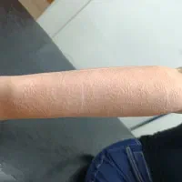 لیزر مو دائمی با دستگاه الکس کندلا اصل آمریکا|خدمات آرایشگری و زیبایی|اصفهان, سعادتآباد|دیوار