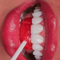 تخفیف  ویژه ۵۰ ٪ کامپوزیت