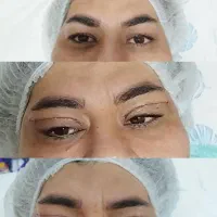 مژده همشهریان عزیزتخفیف 30 درصد خدمات جراحی ساکشن