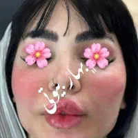 تخفیف خدمات تخصصی ژل بوتاکس مادلینگ مزوتراپی آنزیم|خدمات آرایشگری و زیبایی|کرمانشاه, |دیوار