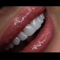 کامپوزیت دندان فکی ۵ ت اقساط لبه شیشه ای|خدمات آرایشگری و زیبایی|تهران, تهرانپارس جنوبی|دیوار