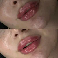 ژل لب-بوتاکس فقط۶۹۹