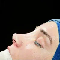جشنواره عمل جراحی بینی فقط 23|خدمات آرایشگری و زیبایی|تهران, سعادت‌آباد|دیوار