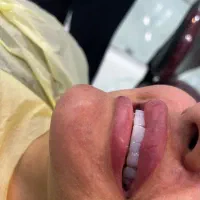 مدل کامپوزیت زیر نظر پزشک در کلینک دنداپزشکی|خدمات آرایشگری و زیبایی|اهواز, کیانپارس |دیوار