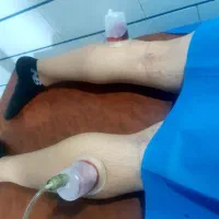 حجامت ۲۲۰هزار،زالو 120هزار