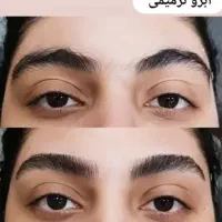 اصلاح تخصصی ابرو