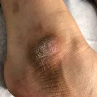 پدیکور پا ،رفع تیرگی ،قوزک پا|خدمات آرایشگری و زیبایی|پاکدشت, پاکدشت (مامازند)|دیوار