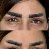 بلفارو پلاستی فقد ۸ تومان