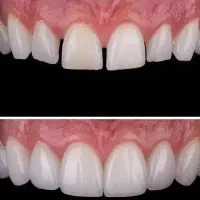 دندانپزشکی اقساطی