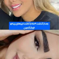 مرکز تخصصی ساکشن غبغب بوکال فت بلفارو کاشت ابرو|خدمات آرایشگری و زیبایی|تهران, پونک|دیوار