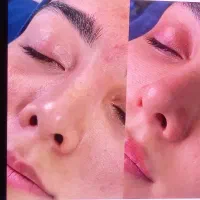 فیشیال پوست تخصصی