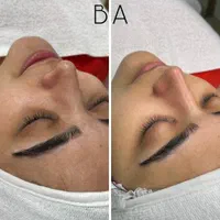 فیشال و پاکسازی کاشت مژه و لیفت ابرو|خدمات آرایشگری و زیبایی|رشت, جانبازان|دیوار
