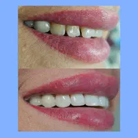 دندانپزشکی گران نیست، غفلت گران است(نقد اقساط)|خدمات آرایشگری و زیبایی|شیراز, گلدشت معالی‌آباد|دیوار