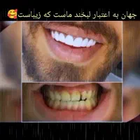 مژده مژده کامپوزیت برای یک ماه  تخفیف ویژه|خدمات آرایشگری و زیبایی|یاسوج, |دیوار