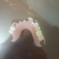 ساخت انواع دندان مصنوعی|خدمات آرایشگری و زیبایی|رشت, دروازه لاکان|دیوار