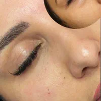 جشنواره پی آرپی ژل و بوتاکس مزوتراپی بلفارو|خدمات آرایشگری و زیبایی|اهواز, کیانپارس |دیوار