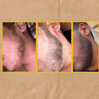بلیط آخر رویشی