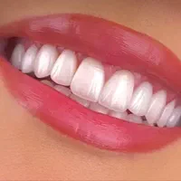 ساخت روکش دندان