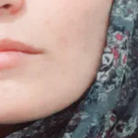 کرم ضدلک قوی سفیدکننده|آرایشی، بهداشتی، درمانی|جوانرود, |دیوار