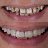 دندانپزشکی مجهز به بی حسی بدون درد دیجیتالی+اقساط