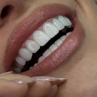 دعوت به همکاری مشاور تلفنی کلینیک دندانپزشکی