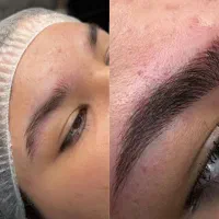 مدل میکروبلیدینگ با مواد حرفه ای