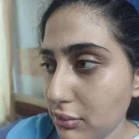 زیبایی بینی۲۹تومن با متخصص گوش و حلق و بینی|خدمات آرایشگری و زیبایی|ورامین, ورامین|دیوار